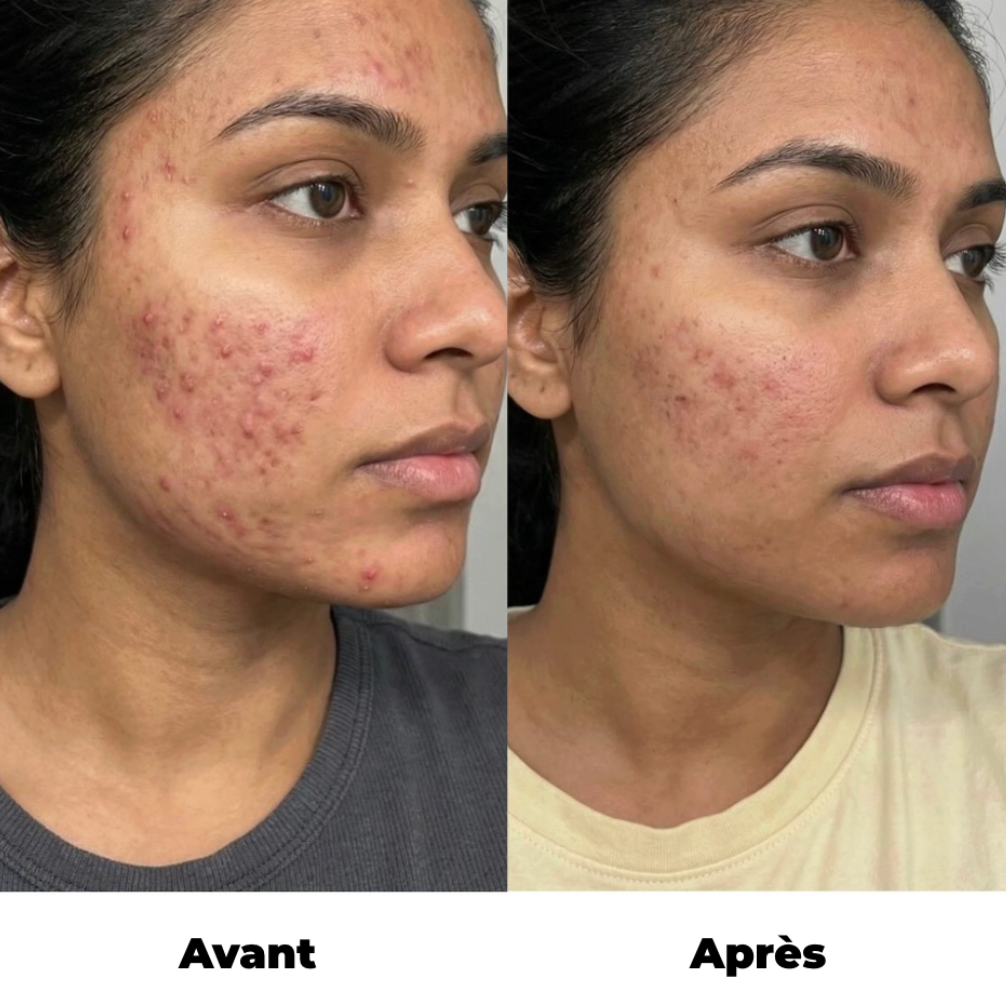 Taie d'oreiller 100% pure soie de mûrier